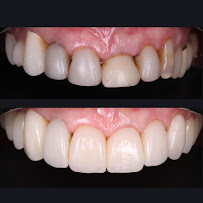 Clínica dental Viña del mar: Dr. Javier González