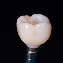 Clínica dental Viña del mar: Dr. Javier González