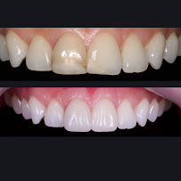 Clínica dental Viña del mar: Dr. Javier González
