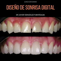 Clínica dental Viña del mar: Dr. Javier González