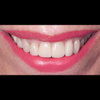 Clínica dental Viña del mar: Dr. Javier González