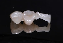 Urgencia Dental 24 Horas - Centro Odontológico Viña Del Mar