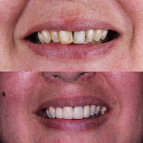 Urgencia Dental 24 Horas - Centro Odontológico Viña Del Mar