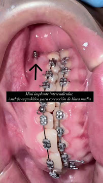 VianPlus