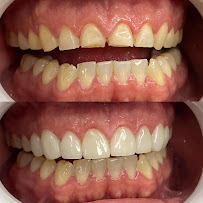 Clínica Dentalife l Dentista Valparaíso
