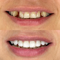Clínica Dentalife l Dentista Valparaíso