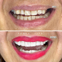 Clínica Dentalife l Dentista Valparaíso