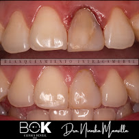 Clínica dental BOK