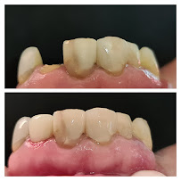 Clínica Dental - Dentista Temuco - Plus Salud