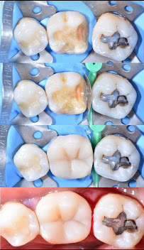Clínica Dental - Dentista Temuco - Plus Salud