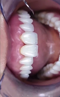 Clínica Dental - Dentista Temuco - Plus Salud