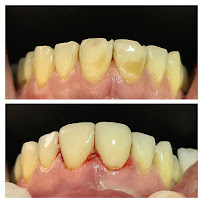 Clínica Dental - Dentista Temuco - Plus Salud