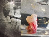 Urgencia Dental Temuco