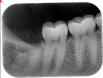 Urgencia Dental Temuco