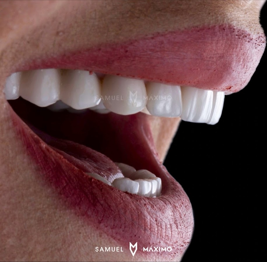 Clínica Samuel Máximo Dentista 24 Horas Urgencias Dentales - dental clinic in Mexico City, Mexico