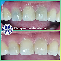 Centro Medico Clinica Dental Urgencias Dentales Iquique ODOMED