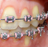 Alicura Conception Orthodontics - Dental Clinic - Dentist