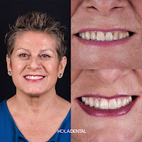 Clinica Dental - Hola Dental Concepción