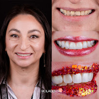 Clinica Dental - Hola Dental Concepción