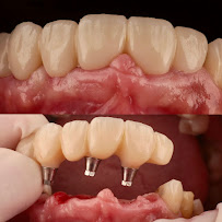Clínica RZT Implantología y Odontología