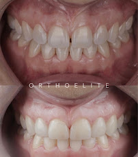 Clínica Dental Orthoelite