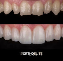 Clínica Dental Orthoelite
