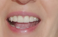 Clínica dental Dr. Alejandro Rodríguez l Diseños de sonrisa l Carillas l Coronas dentales l Urgencias dentales