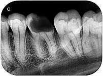 Studio Radiológico Dental Chillan