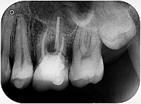 Studio Radiológico Dental Chillan