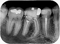 Studio Radiológico Dental Chillan