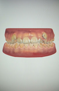 Clínica Dental Coquimbo