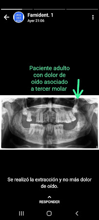 Ortodoncia Famident - Prótesis dentales - Exodoncias - Extracciones dentales