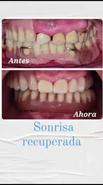 Ortodoncia Famident - Prótesis dentales - Exodoncias - Extracciones dentales