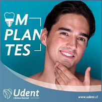 Udent Clínica Dental