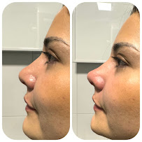 Calama -Fulmeds spa Nobeldent Clinical Dentistry