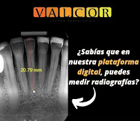 Centro Radiológico Valcor