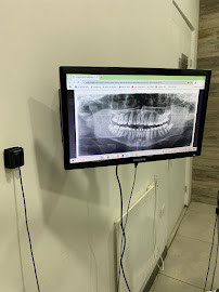 Clínica Dental Osorno Montt y Frenillos, Ortodoncia en Osorno