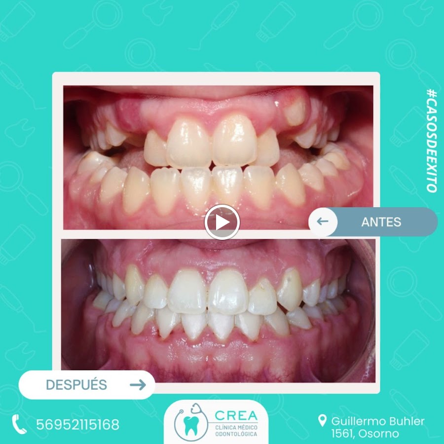 Dental Clinic Clinica Crea Osorno dental clinic in Osorno