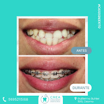 Clinica Crea Osorno