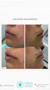 Clinica Crea Osorno