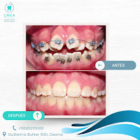 Clinica Crea Osorno