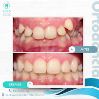 Clinica Crea Osorno