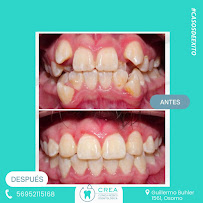 Clinica Crea Osorno