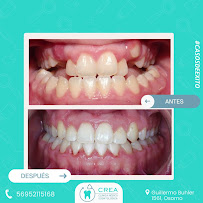 Clinica Crea Osorno Dental Clinic in Osorno, Chile