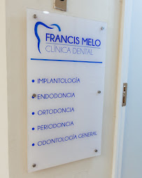 Clínica Dental Dr. Francis Melo | Copiapó