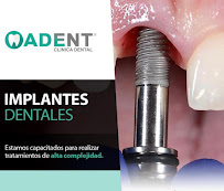 Clinica Adent Curicó