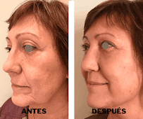 Odontofacial Curicó