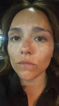 Dra Nicol Rojas - Armonización y Rejuvenecimiento Facial