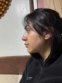 Dra Nicol Rojas - Armonización y Rejuvenecimiento Facial
