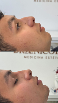 Dra Nicol Rojas - Armonización y Rejuvenecimiento Facial